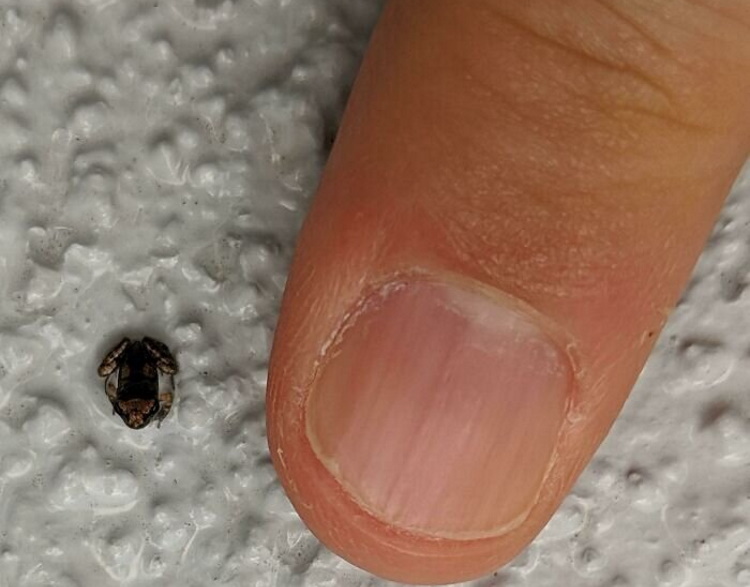 1-5 Самый маленький лягушонок в мире.jpg