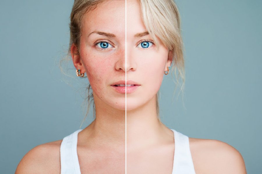 чувствительная кожа.jpg