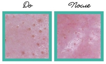 до и после.jpg