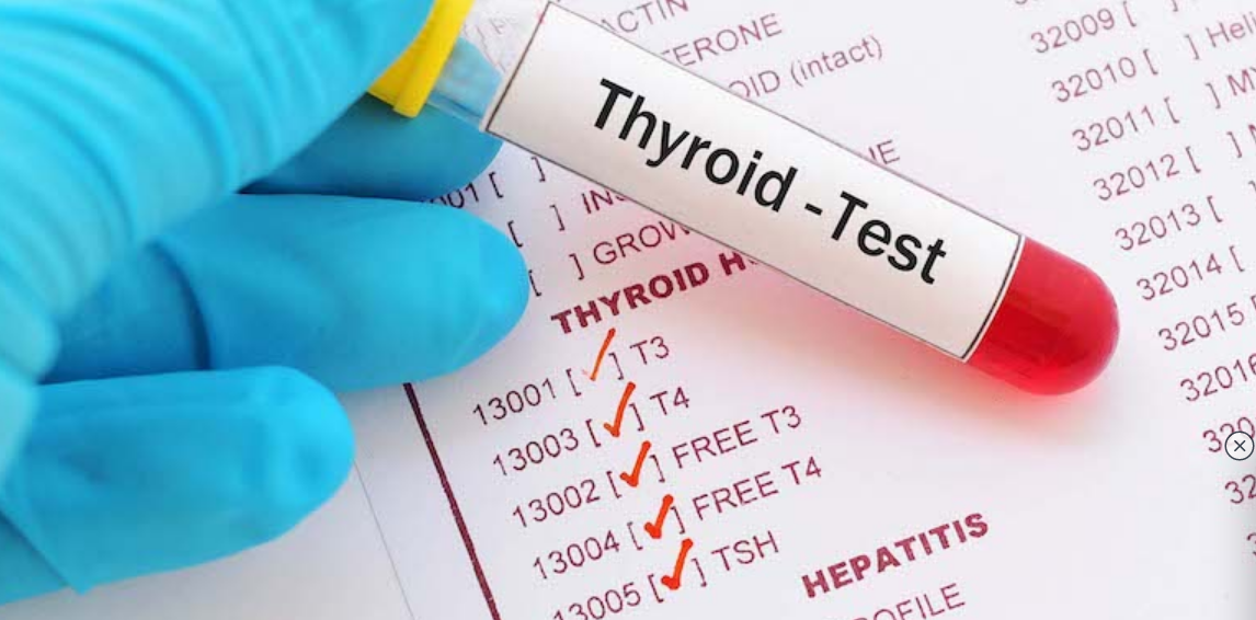 Screenshot 2023-10-17 at 09-02-23 Курс «Гипотиреоз и гипоксия. От понимания к решению.».png