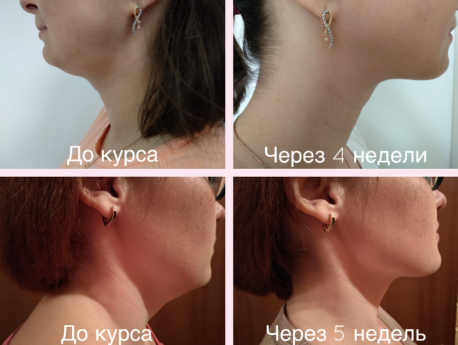 Screenshot_2019-03-01 Онлайн-курс по естественному омоложению лица.png